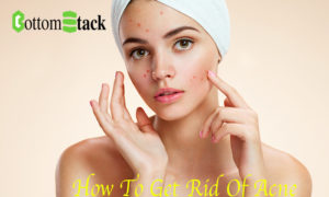 how to get rid of acne